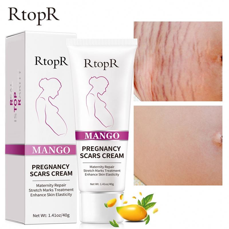 RtopR Mango Remove Pregnancy Scars Cream Repair Anti-Aging Anti Winkles Firming Body Creams