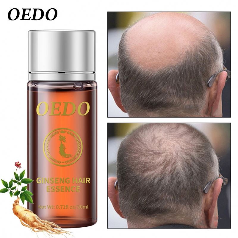 Oem OEDO Ginseng Prevent Loss Essential Oil Hair Growth Black and Shines Repair Hair-root Moist Nourishing Serum