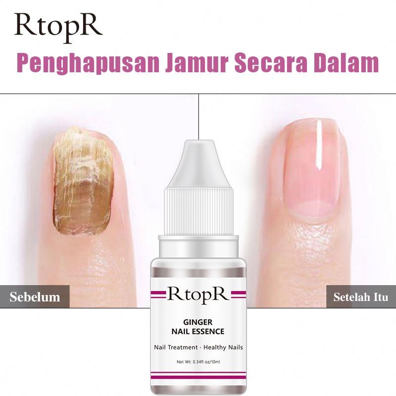 New Oem RtopR Liquid Repair Care Nutrient Solution Ginger Nail Essential Oil Anti-fungal Nourishing