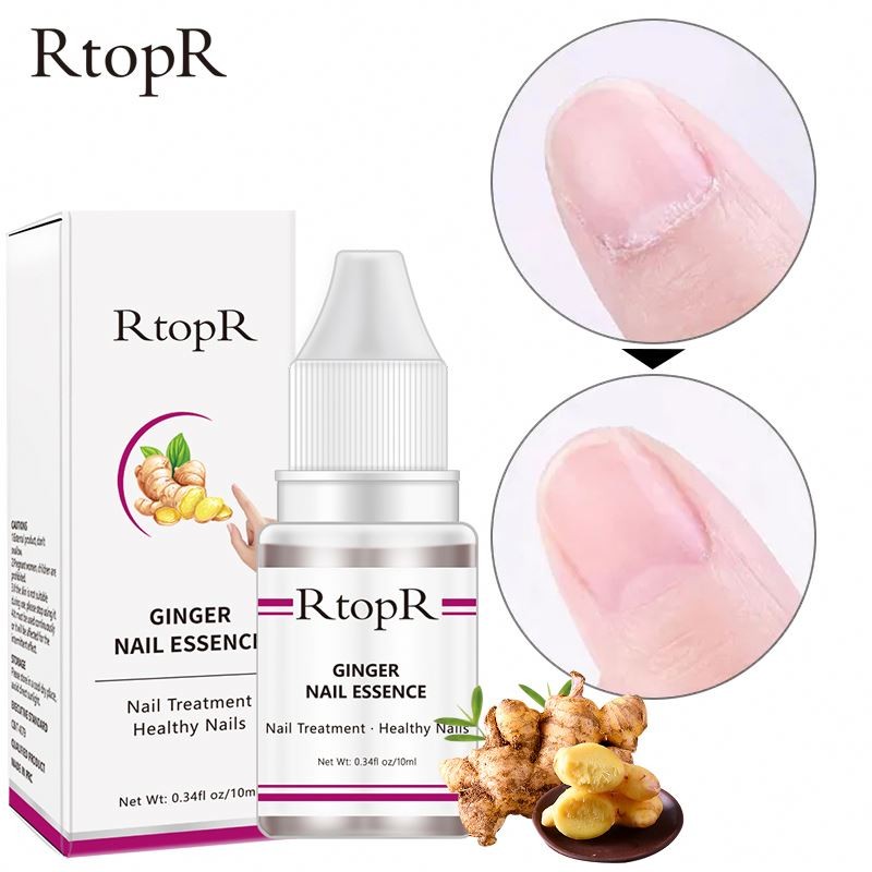 New Oem RtopR Liquid Repair Care Nutrient Solution Ginger Nail Essential Oil Anti-fungal Nourishing