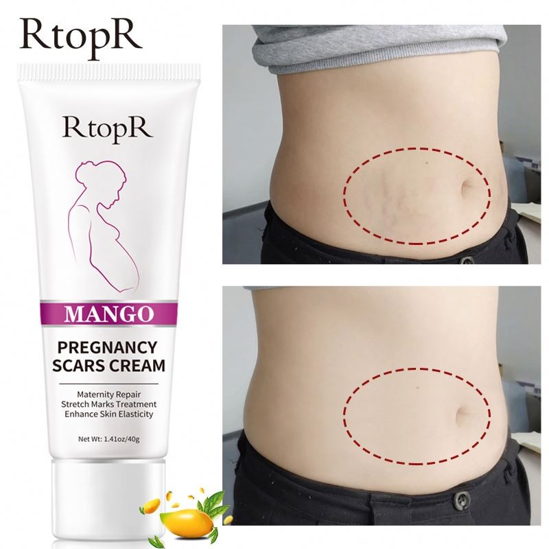 RtopR Mango Remove Pregnancy Scars Cream Repair Anti-Aging Anti Winkles Firming Body Creams