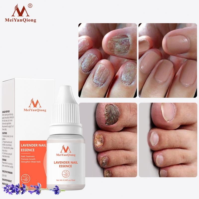 Oem Anti Infection Strong Treating Fungal Infections Nail Treatment Lavender Serum Oil for Nails and Cuticles