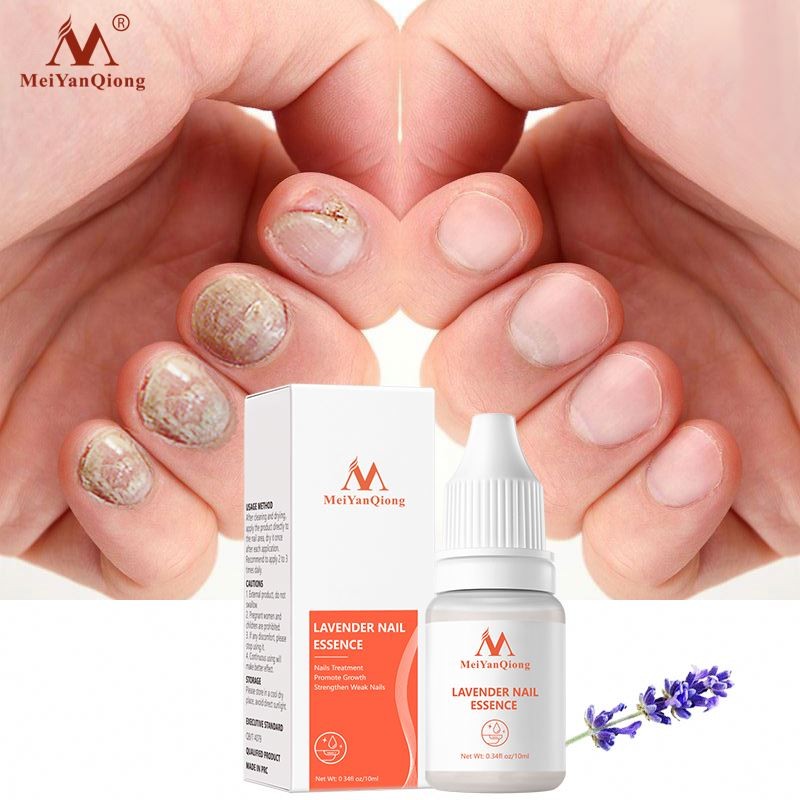 Oem Anti Infection Strong Treating Fungal Infections Nail Treatment Lavender Serum Oil for Nails and Cuticles