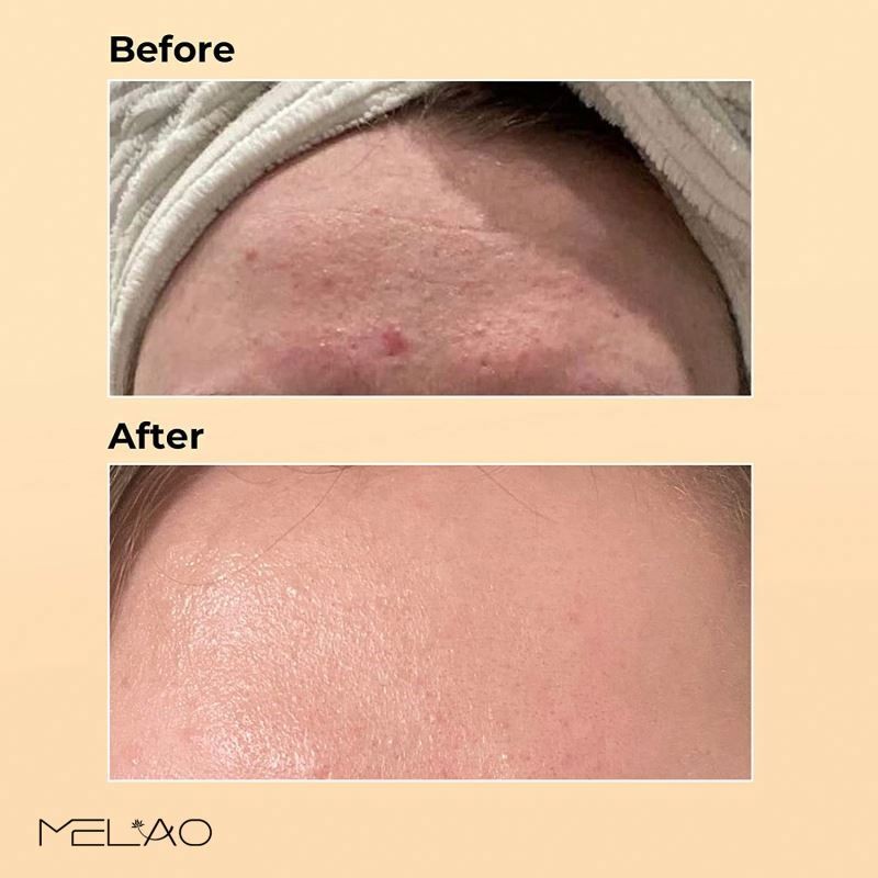 Wholesale Serum Private Label Moisturizing Whitening Anti Wrinkle Fading Blemishes Fine Lines Pores Shrink Snail Mucin