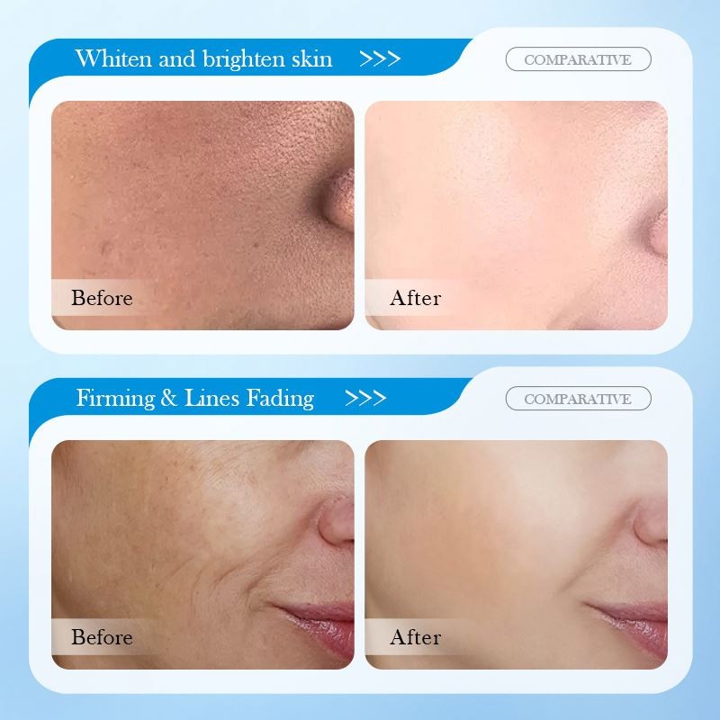 Wholesale SADOER 8D Hyaluronic Acid Facial 25ml Anti-wrinkle Nourishing Moisturizing and Brightening Mask Skin Care