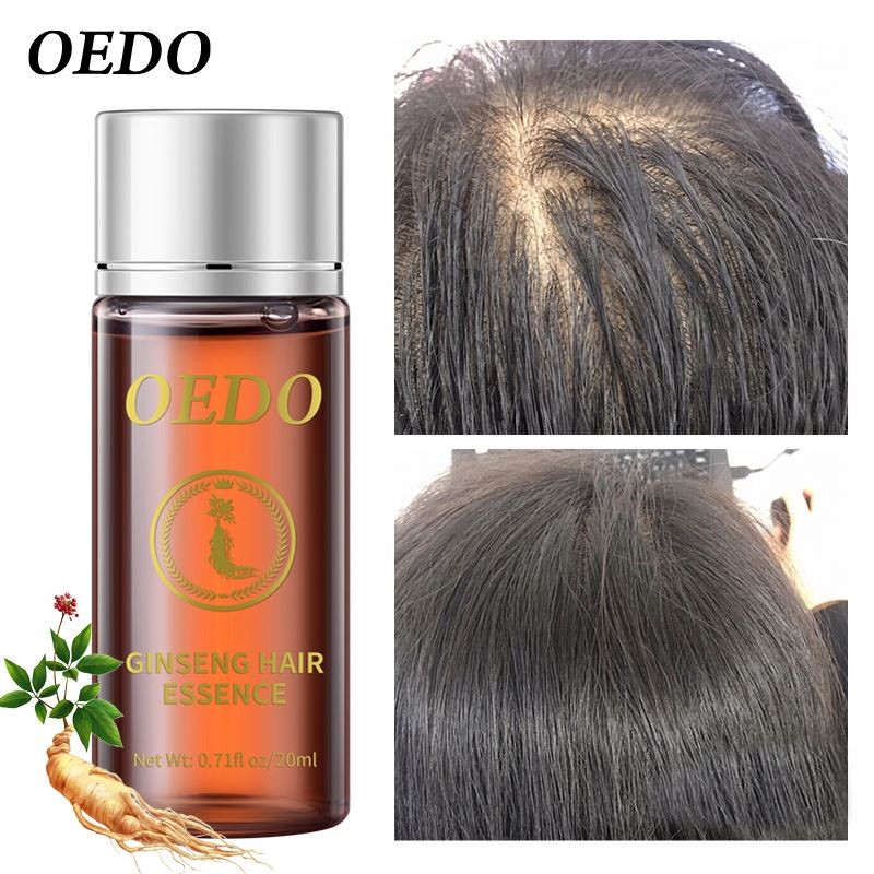 Oem OEDO Ginseng Prevent Loss Essential Oil Hair Growth Black and Shines Repair Hair-root Moist Nourishing Serum