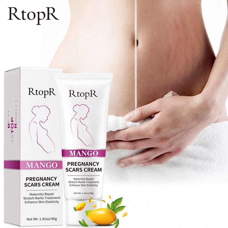 Oem Repair Remove Pregnancy Maternity Scars Treatment Body Skin Care Stretch Mark Cream