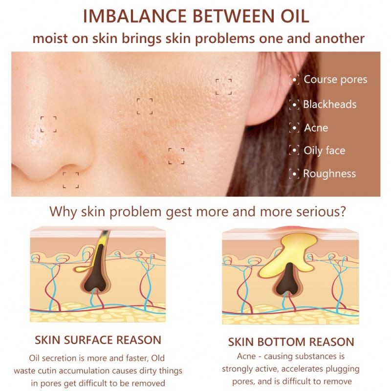 factory Custom Private Label Blackhead Remover Shrink Cleaner Pore Minimizer Pores OEM ODM Face Wrinkle Skin Care Serum