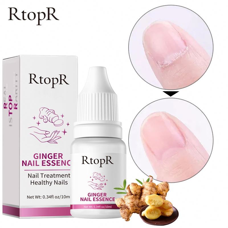 Oem RtopR VC Serum Fungus Infection Damaged Fingernail Repair Solution Anti Bacterial Nail Oil