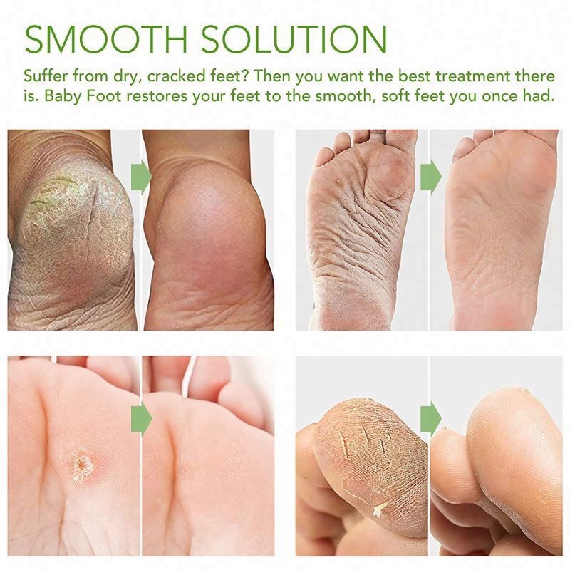 Peel Remove Dead Moisturizing Exfoliating Heel Skin Care Peeling Foot Mask