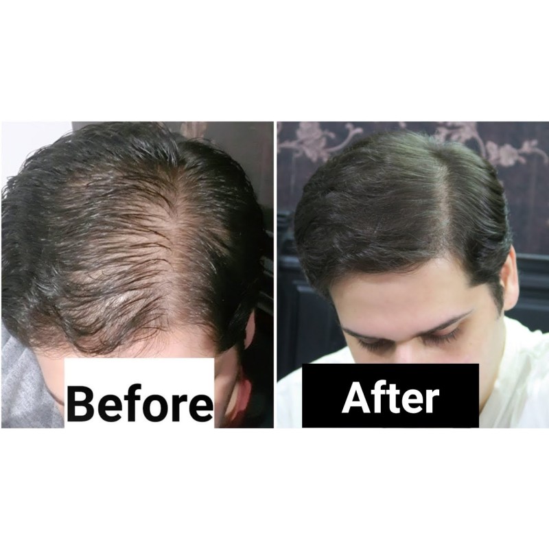 Rosemary Hydrosol Factory - Pure Natural Bulk Price