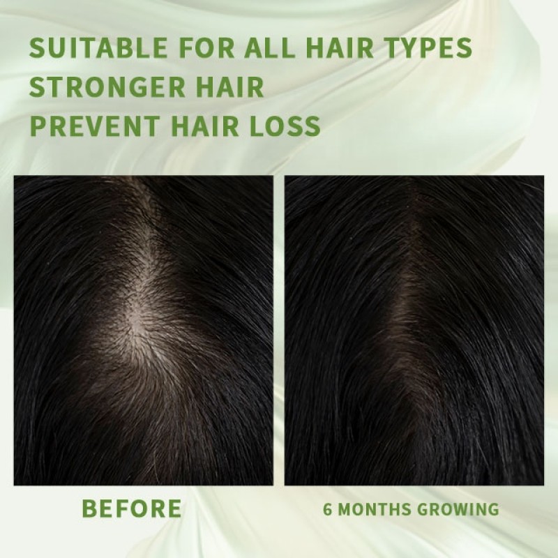 Biotin Capsule Factory - Private Label Hair Growth Collagen Whitening