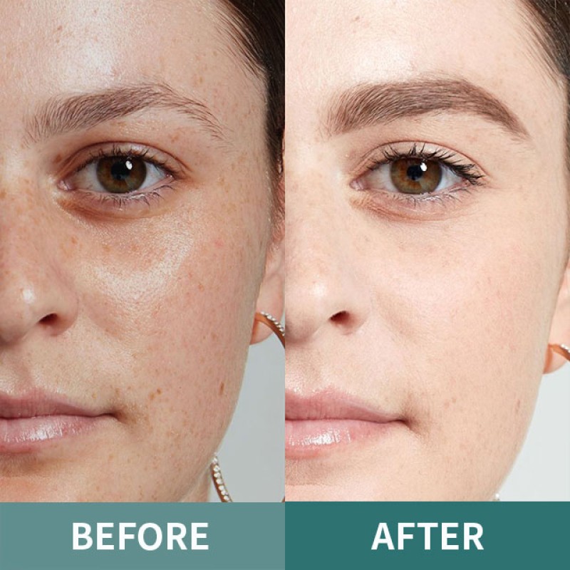 Skin Whitening Capsules Supplier - Herbal Beauty Products Export