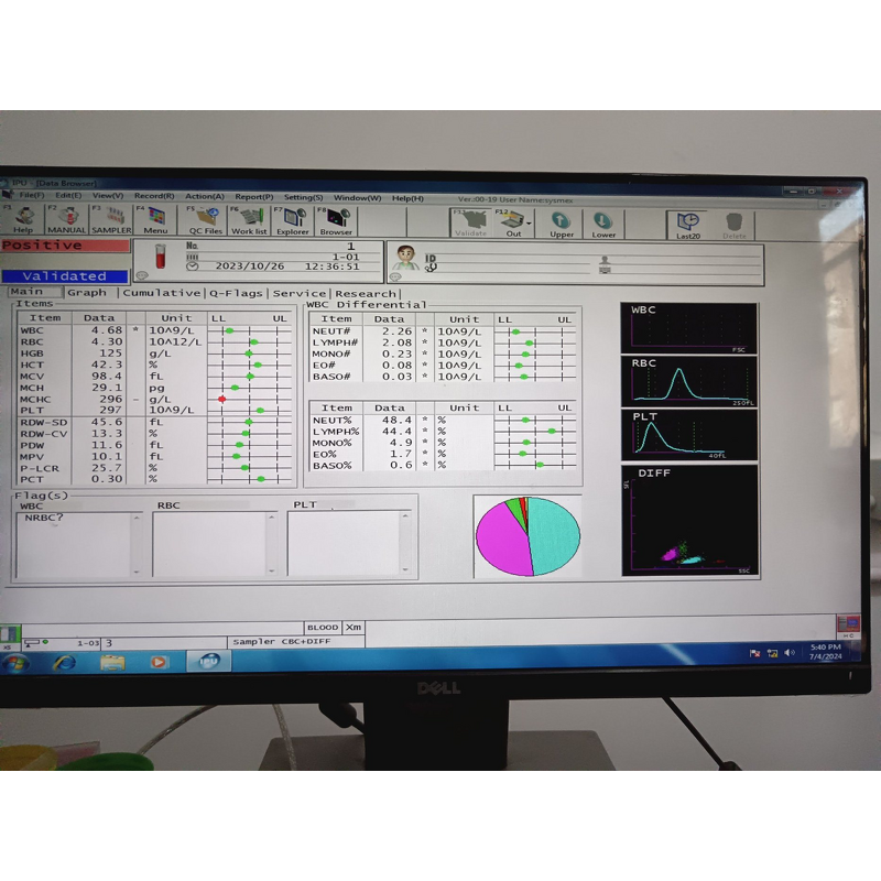 Hematology Analyzer Factory - Sysmex XS1000I Compact 5-Part
