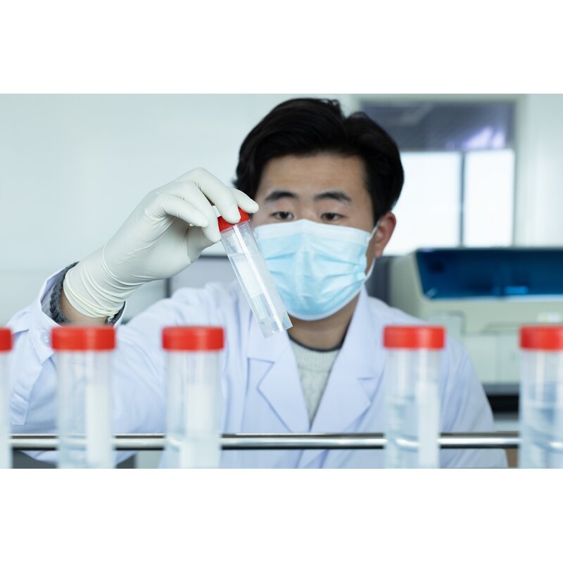 Buffer Solution Manufacturer - Abbott Architect Stimulation