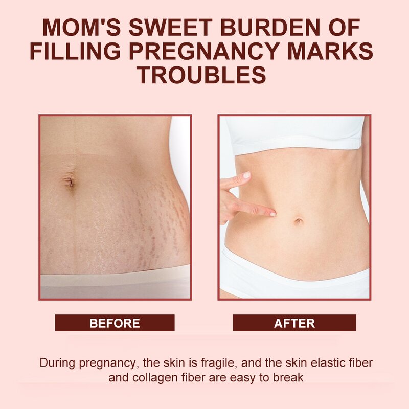 Stretch Mark Oil Supplier - Wholesale 500ml Plant-Based Skin Repair