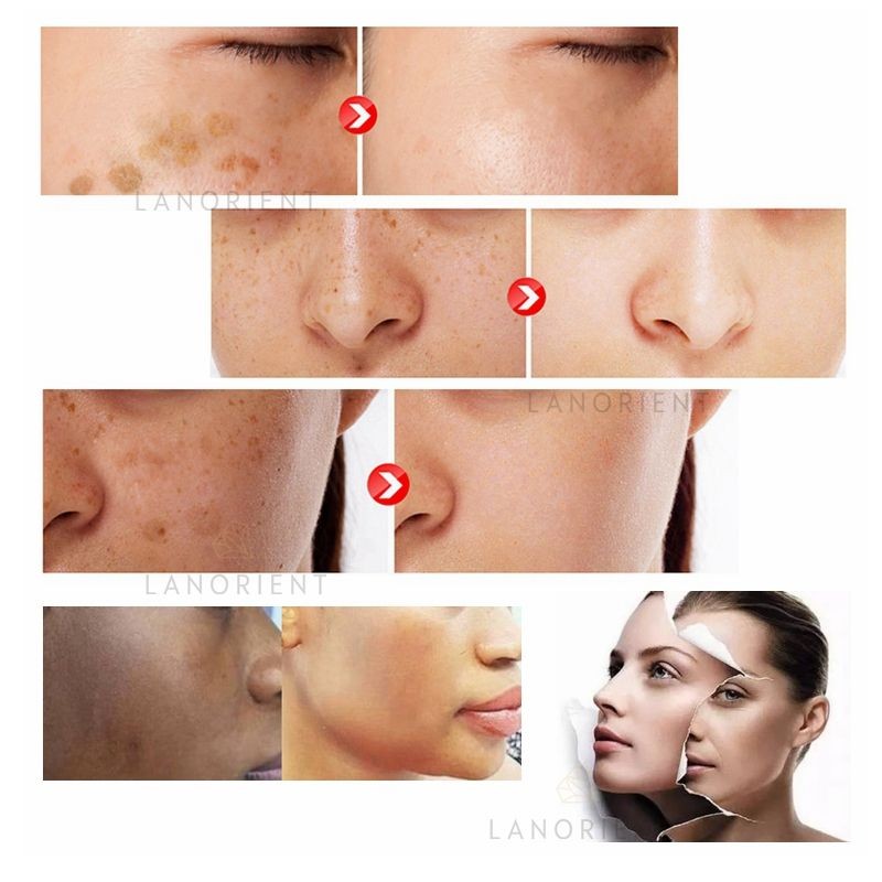 Collagen Capsule Manufacturer - 10000mg Skin Whitening Booster