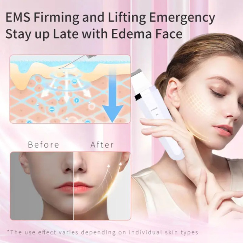 Vibration Cleaner Ultrasnica Peeling Pores Dirt Spatula Facial Skin Scraper Stainless Steel Scrubber