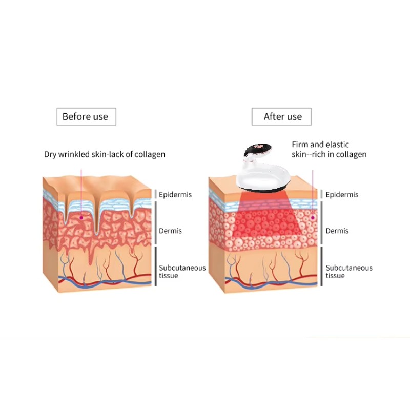 EMS Massage Device Body Contouring & Slimming Device for Fat and Cellulite Burner