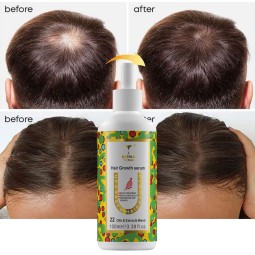 Hair Growth Serum Manufacturer - OEM Precious Blend Rare Oils Treatment