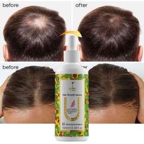 Hair Growth Serum Manufacturer - OEM Precious Blend Rare Oils Treatment
