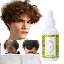 Hair Strengthening Oil Supplier - Rosemary Mint Dry Nourishing Treatment