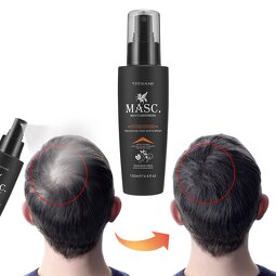 Hair Growth Serum Factory - OEM Biotin Anti Hair Loss Spray