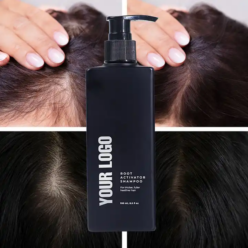 Hair Growth Shampoo Factory - OEM/ODM Gentle Cleansing Oil Control