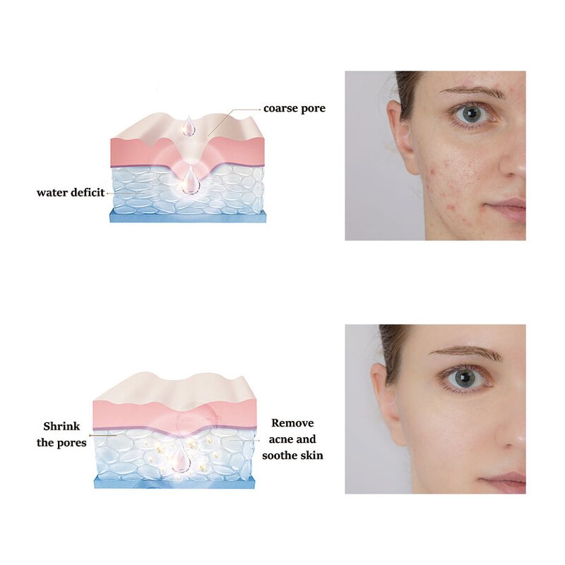 PDRN Serum Manufacturer - Professional Custom Organic Whitening Rejuvenation