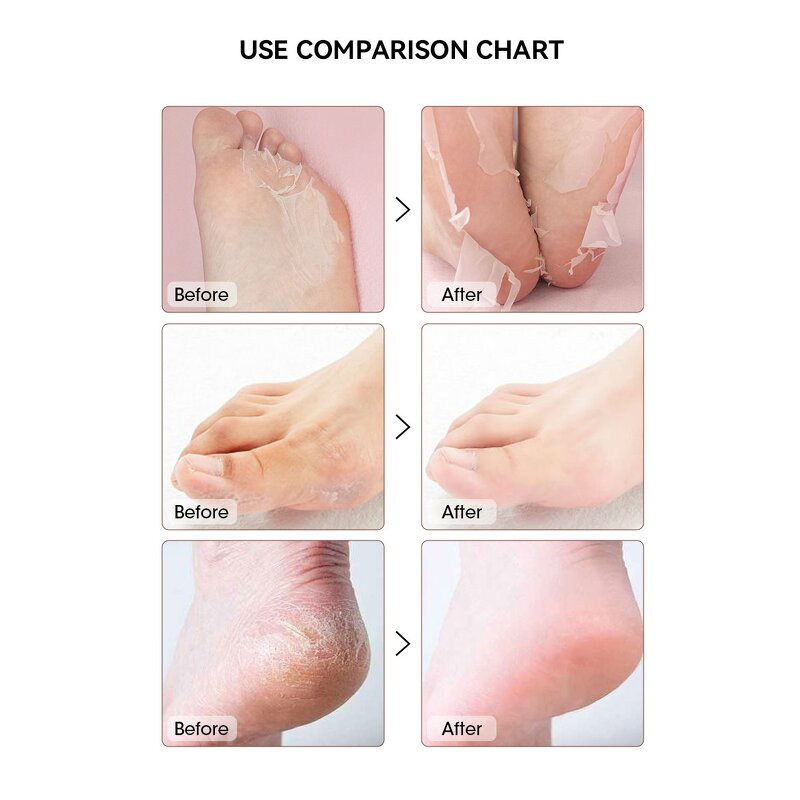 Foot Peel Mask Manufacturer - Efficient Repair Peeling Customized Logos