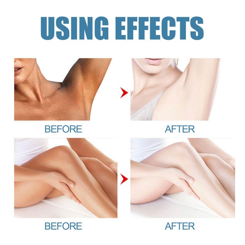 Whitening Cream Manufacturer - Semi-finished Bulk for Dark Skin Private Parts