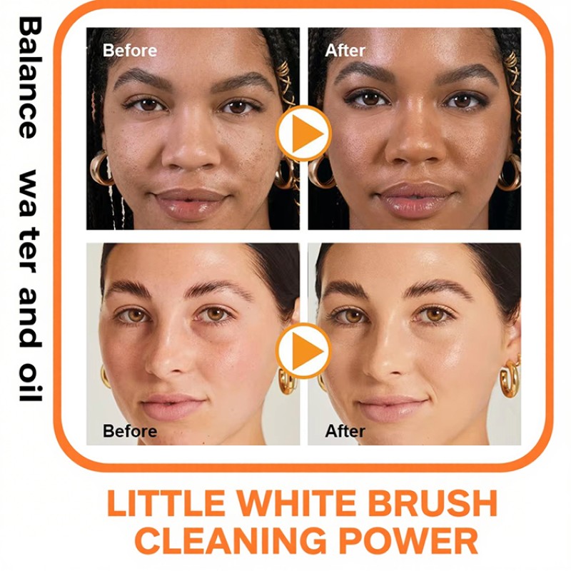 Facial Cleanser Supplier - Private Label Deep Cleansing Anti-Acne Kojic Acid