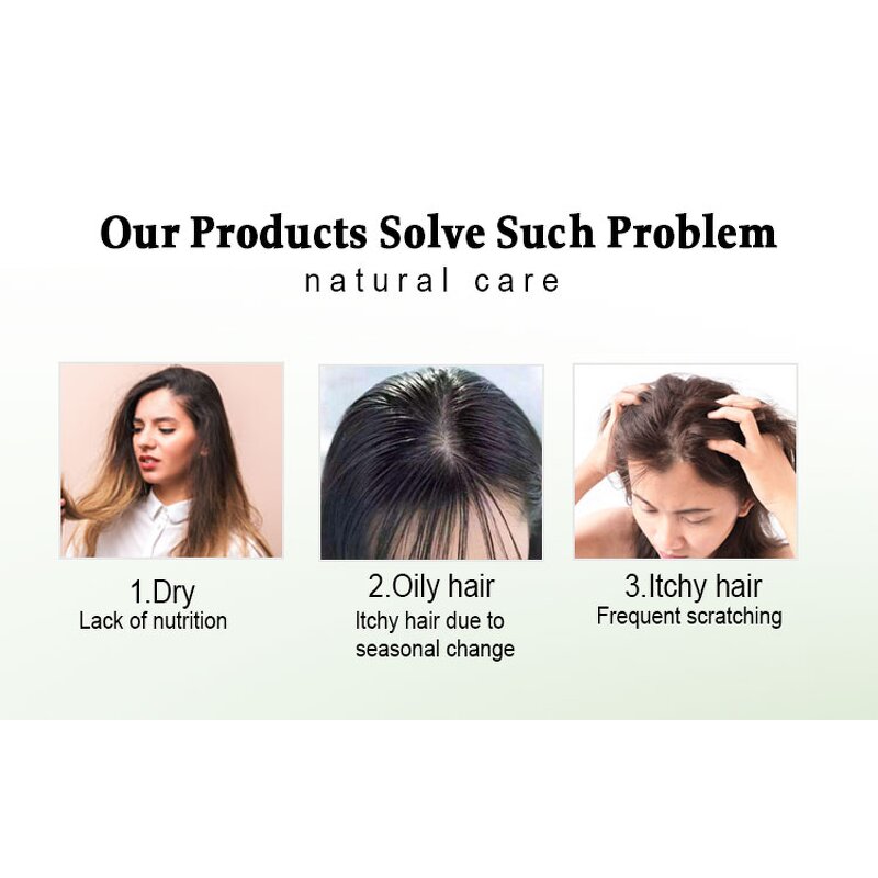 Hair Shampoo Factory - 100% Natural Green Plant Anti-Hair Loss Scalp