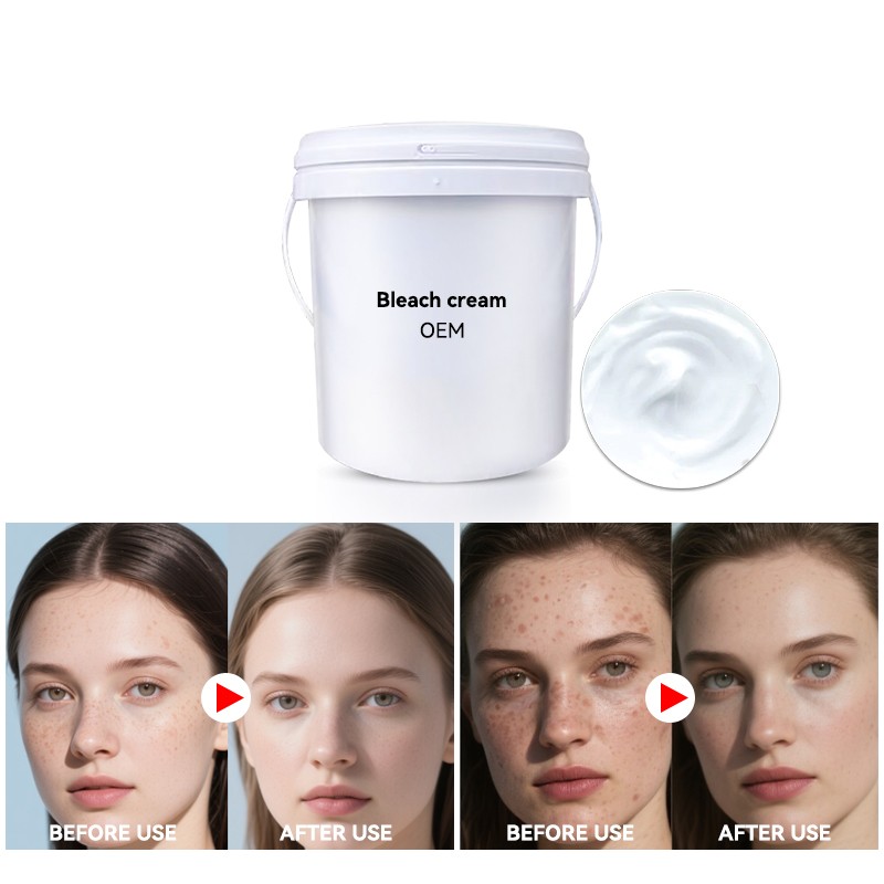 Whitening Cream Factory - Semi-finished 3-7 Day Effective Dark Knuckle