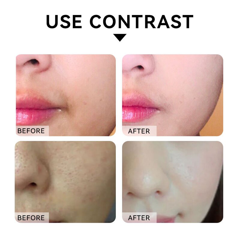 PDRN Serum Supplier - Whitening Spot Anti-Wrinkle Beauty Oil Essence