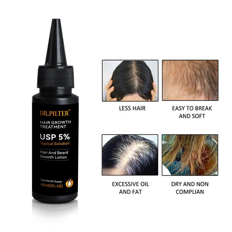 Hair Growth Serum Factory - Private Label 5% Herbal Plant Extract Regrowth