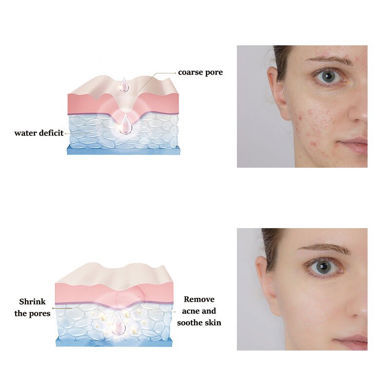 PDRN Serum Manufacturer - Professional Custom Organic Whitening Rejuvenation