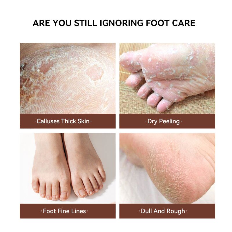 Foot Peel Mask Manufacturer - Efficient Repair Peeling Customized Logos