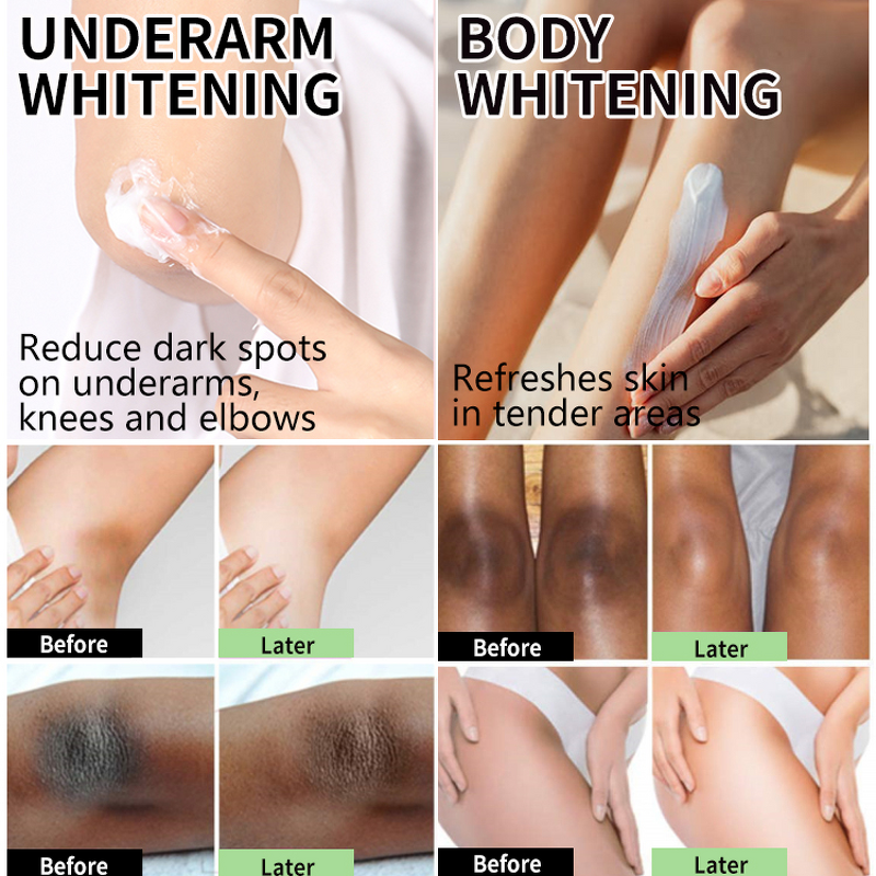 Whitening Cream Factory - Semi-finished 30% for Dark Knees Knuckles