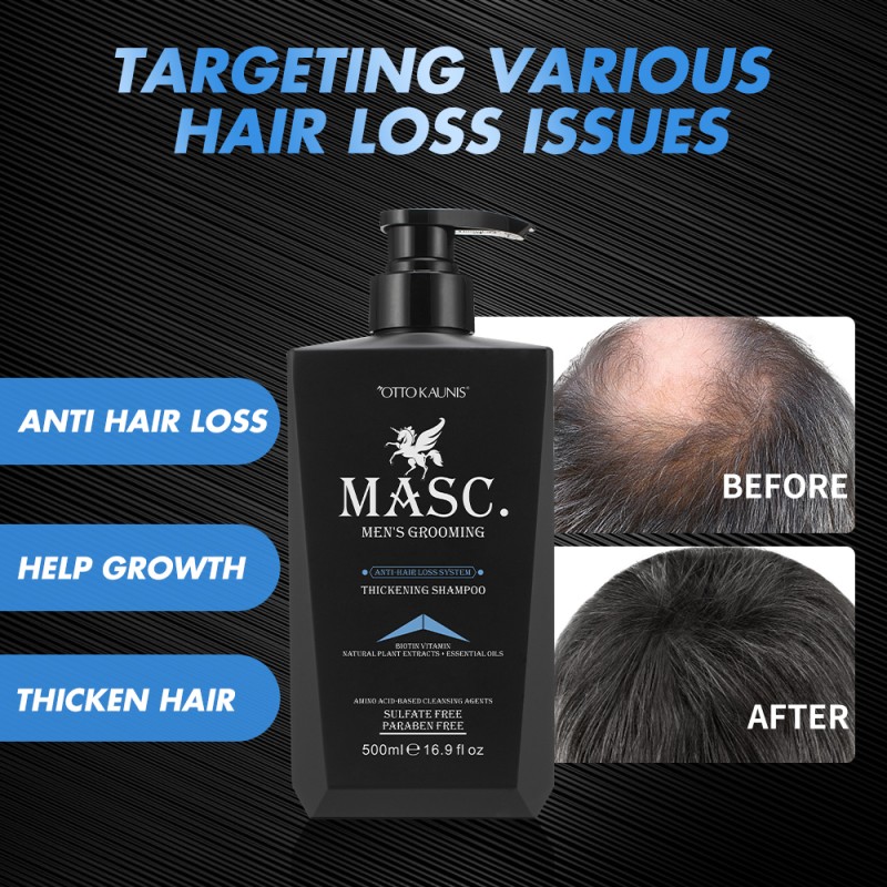 Ginger Biotin Hair Growth Shampoo Set Manufacturer - Private Label Natural Restoration