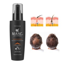 Anti Hair Loss Spray Manufacturer - OEM/ODM Biotin Argan Ginger Rosemary Promote Growth