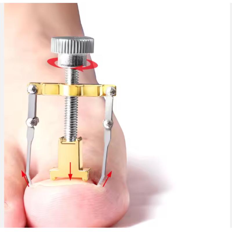 2025 Hot Sales Wholesale Stainless Steel Ingrown Toenail Correction Tool Pedicure Toenail Fixer Corrector