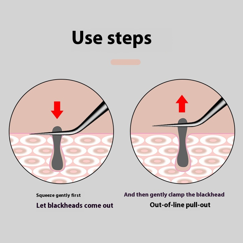 Wholesale Beauty Care Tool Blackhead Tweezers Comedone Acne Needle Pimple Extractor for Facial Care Makeup Tools