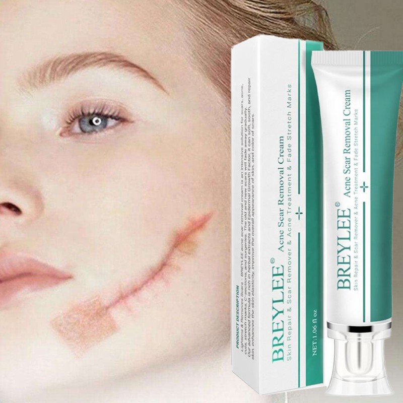 OEM/ODM Private Label Remove Scar Skin Repairing Gel Removal Repair Burn and Scald Vitamin C Herbal Scar Removal