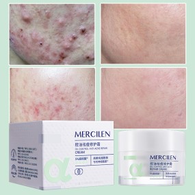 MERCILEN Acne Face Cream Lotion Salicylic Acid Dark Spot Acne Repair Essence Cream Best Pimples for Acne Pimples Face Cream