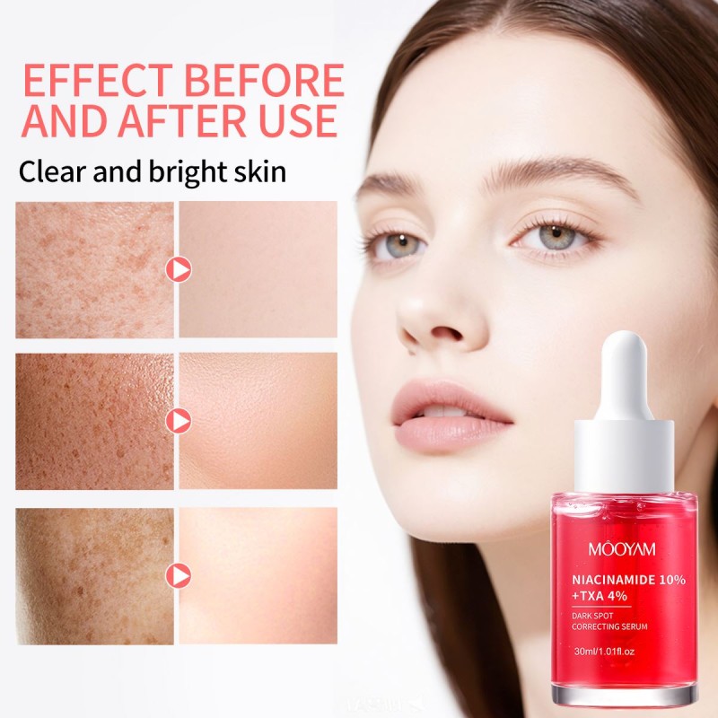Niacinamide Serum Dark Spot Remover Skin Brightener & Tone Corrector Private Label OEM/ODM 30ml Whitening Facial Serum