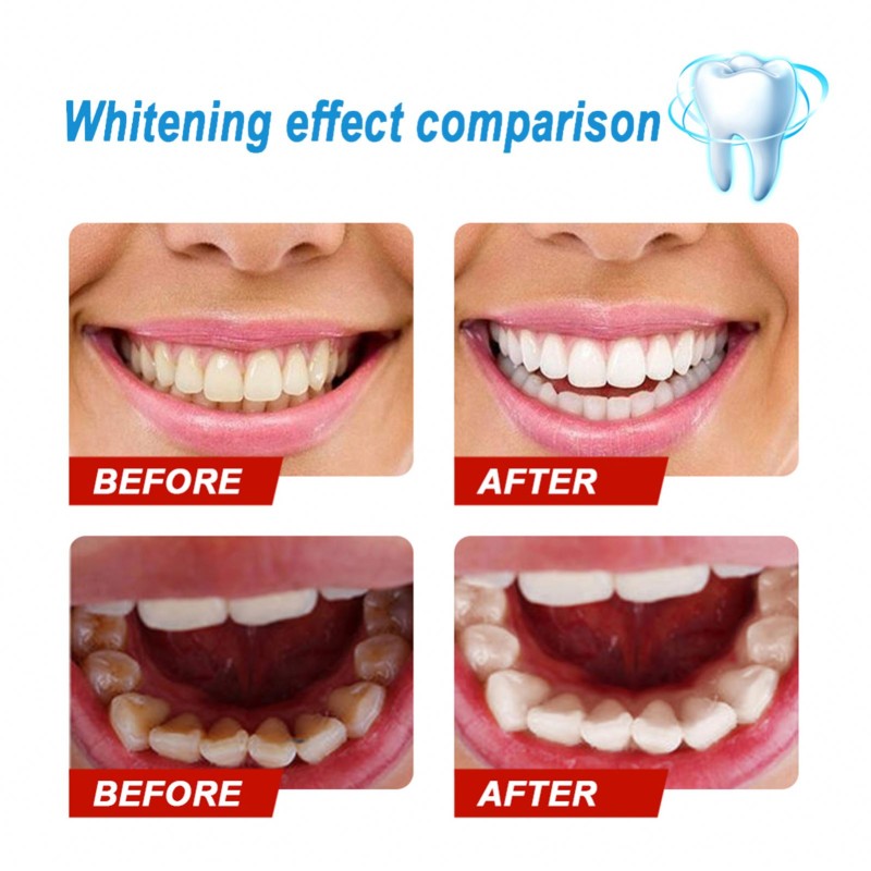 Professional Custom 3ml Natural Teeth Whitening Gel Pen Home Use Press Twist Cleaning Teeth Whitening Pen