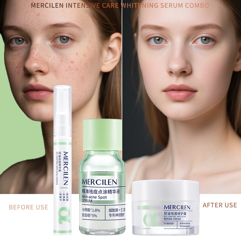 Anti-Acne Facial Skin Care Set Natural Dark Spots Pimples Remover Acne Whitening and Nourishing Tea Tree Acne Skin Care Set