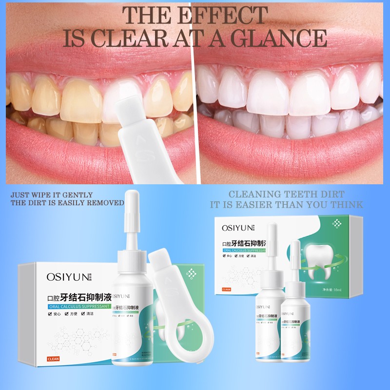 Remove Dental Serum Calculus Eliminate Bad Breath Serum Essence Teeth Whitening Natural Organic Herbal Teeth Whitening Serum