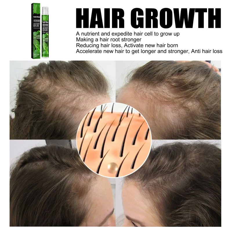 Hot Selling Herbal Instant Mint Hair Growth Serum Organic Concentrated Oil for Daily Use Nourishing Hair Regrowth Hair Grow